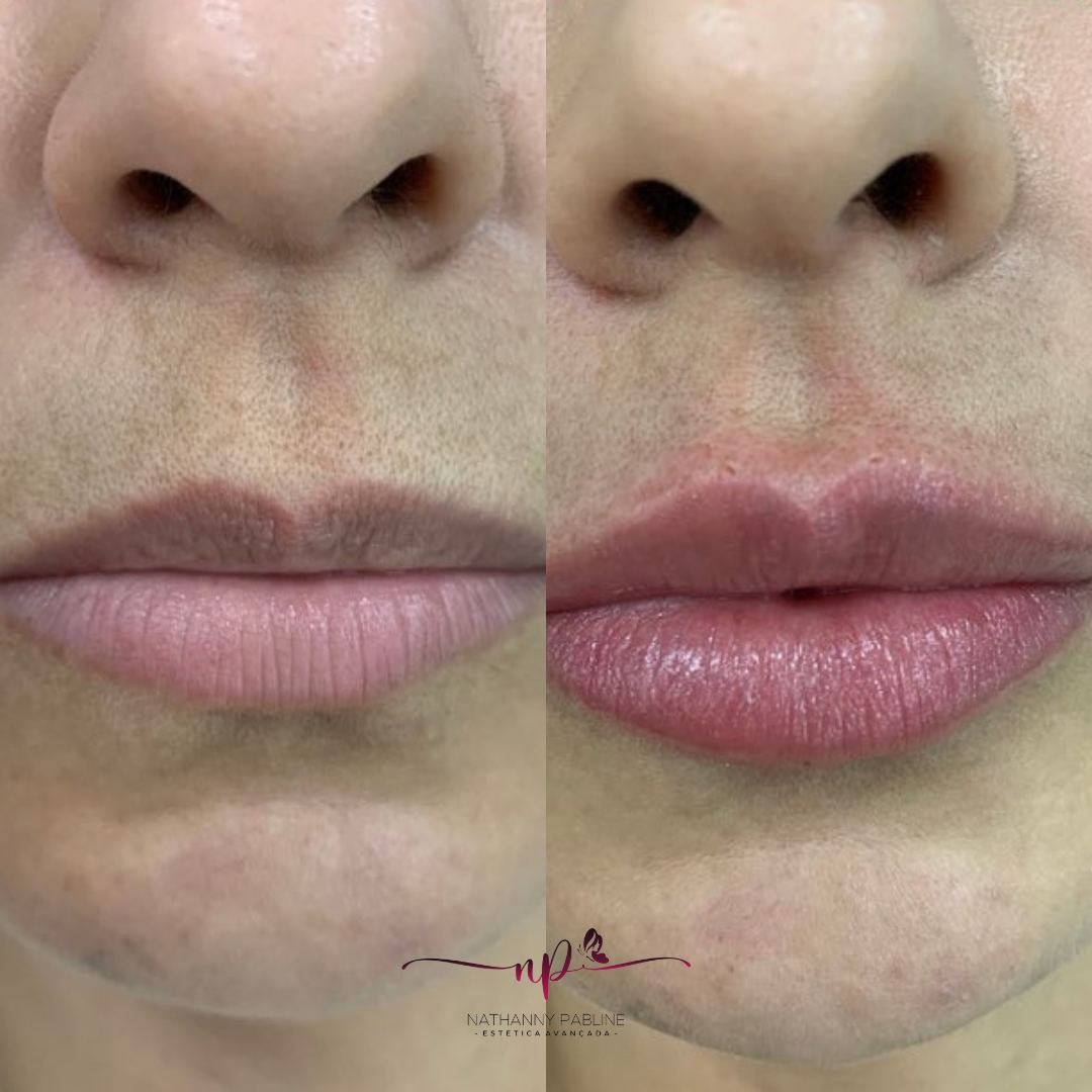 xr:d:DAFDC_Ljc-o:1247,j:47011655817,t:23021423