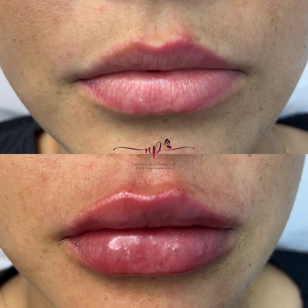 xr:d:DAFDC_Ljc-o:1258,j:3692616465,t:23021423