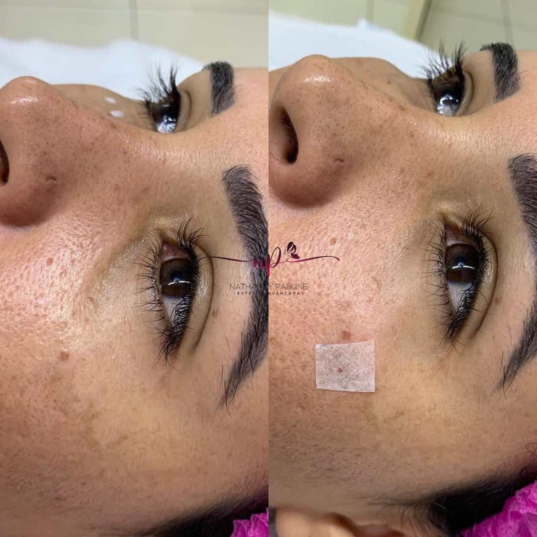 xr:d:DAFDC_Ljc-o:1250,j:3692390025,t:23021423