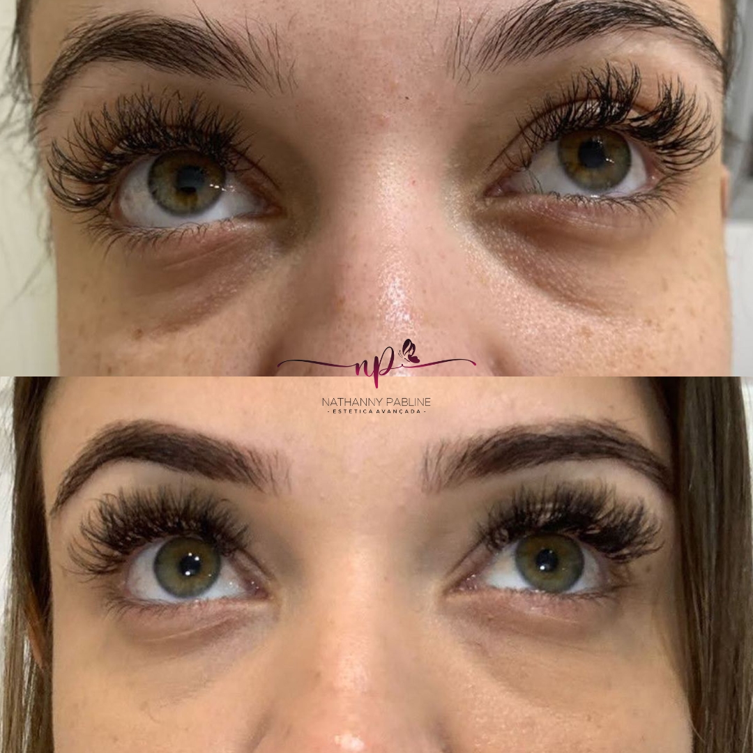 xr:d:DAFDC_Ljc-o:1251,j:47011854915,t:23021423