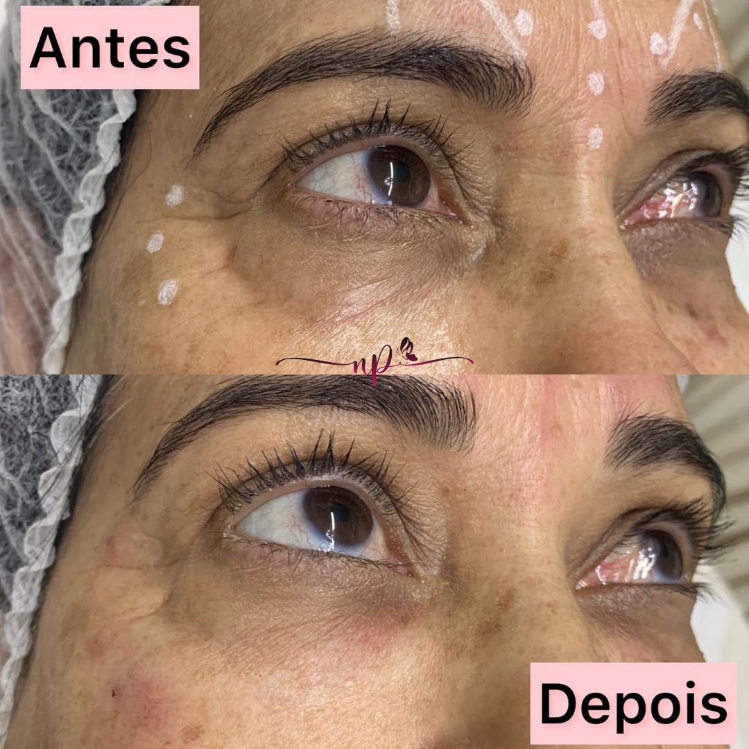 xr:d:DAFDC_Ljc-o:1253,j:3692451969,t:23021423