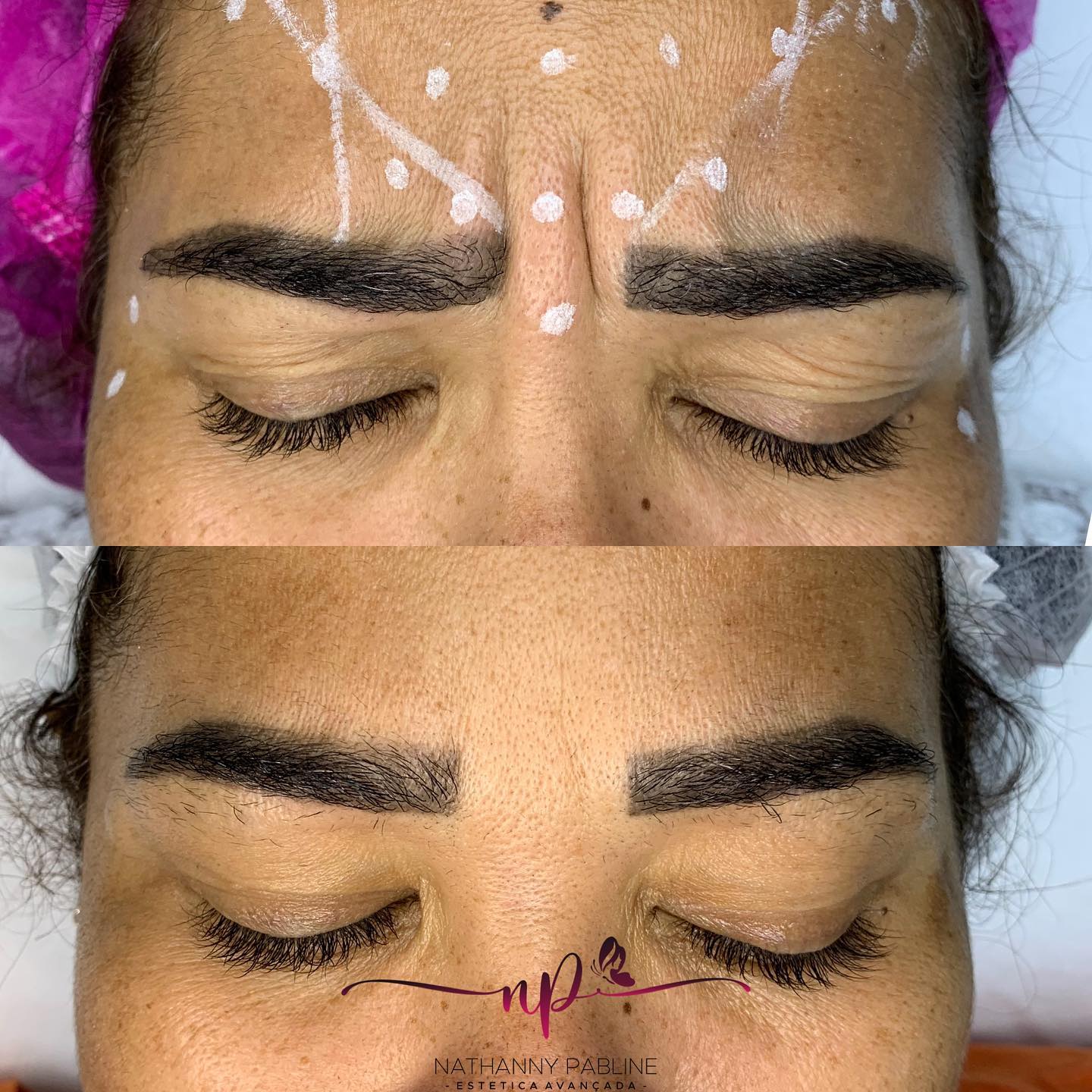 Dra.-Nathanny-Pabline-Toxina-Botulinica-1.2