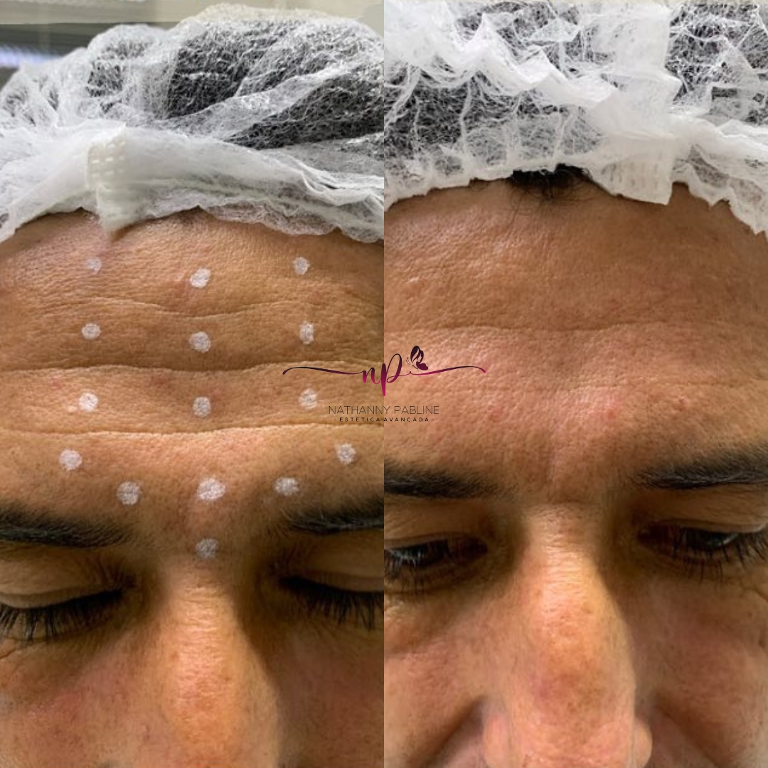 xr:d:DAFDC_Ljc-o:1254,j:47011933341,t:23021423