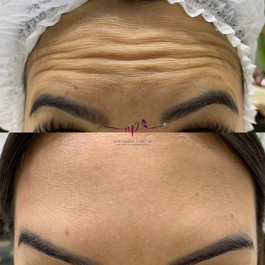 xr:d:DAFDC_Ljc-o:1257,j:3692585187,t:23021423